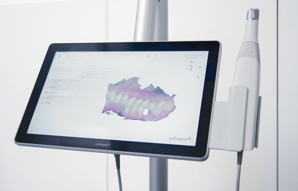 inner 3d image of mouth on a screen