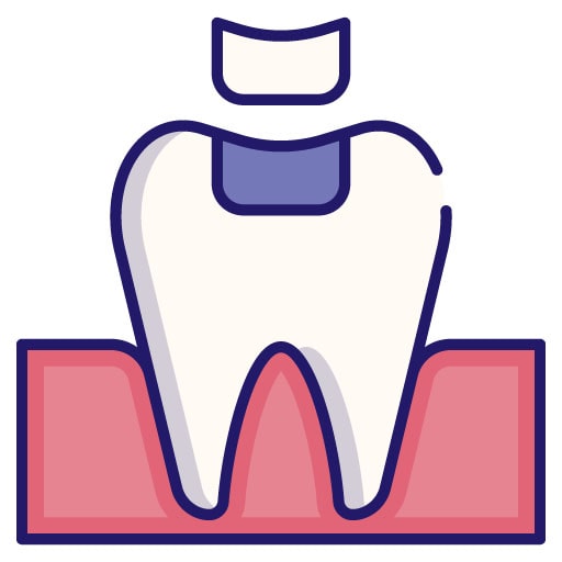 illustration of aesthetic tooth restoration