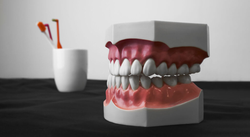 model of full dentures