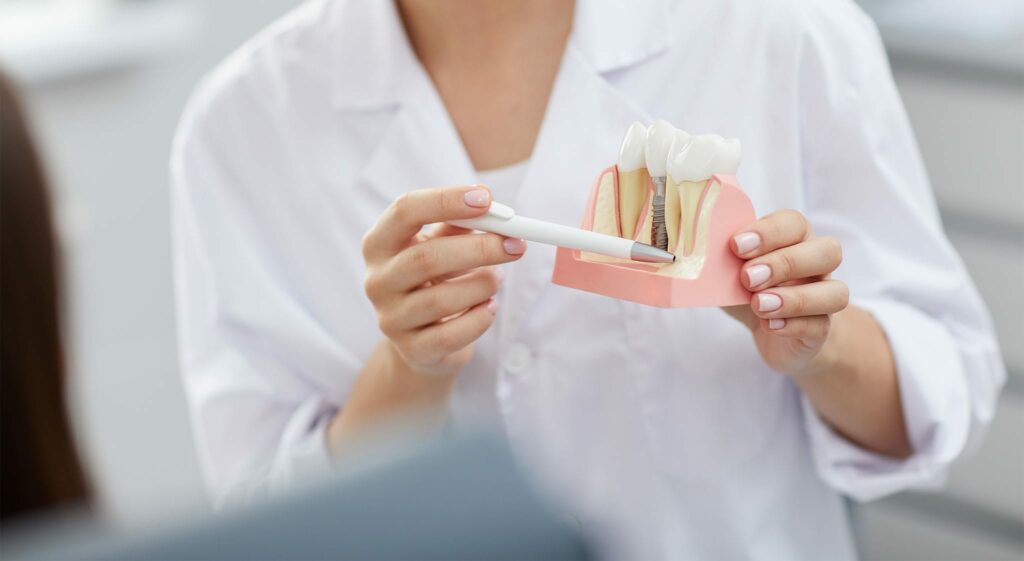 doctor dental implants consultation