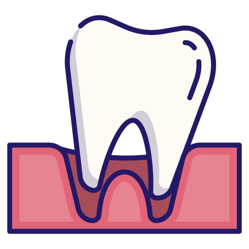 illustration of tooth removal