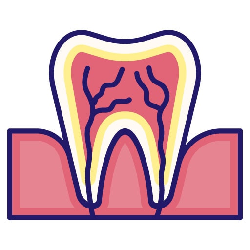 illustration of tooth inflammation
